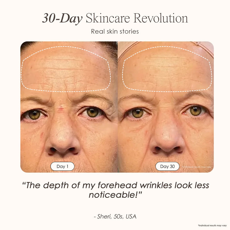 Nuvio 9-Spectrum Anti-Aging Therapy Mask